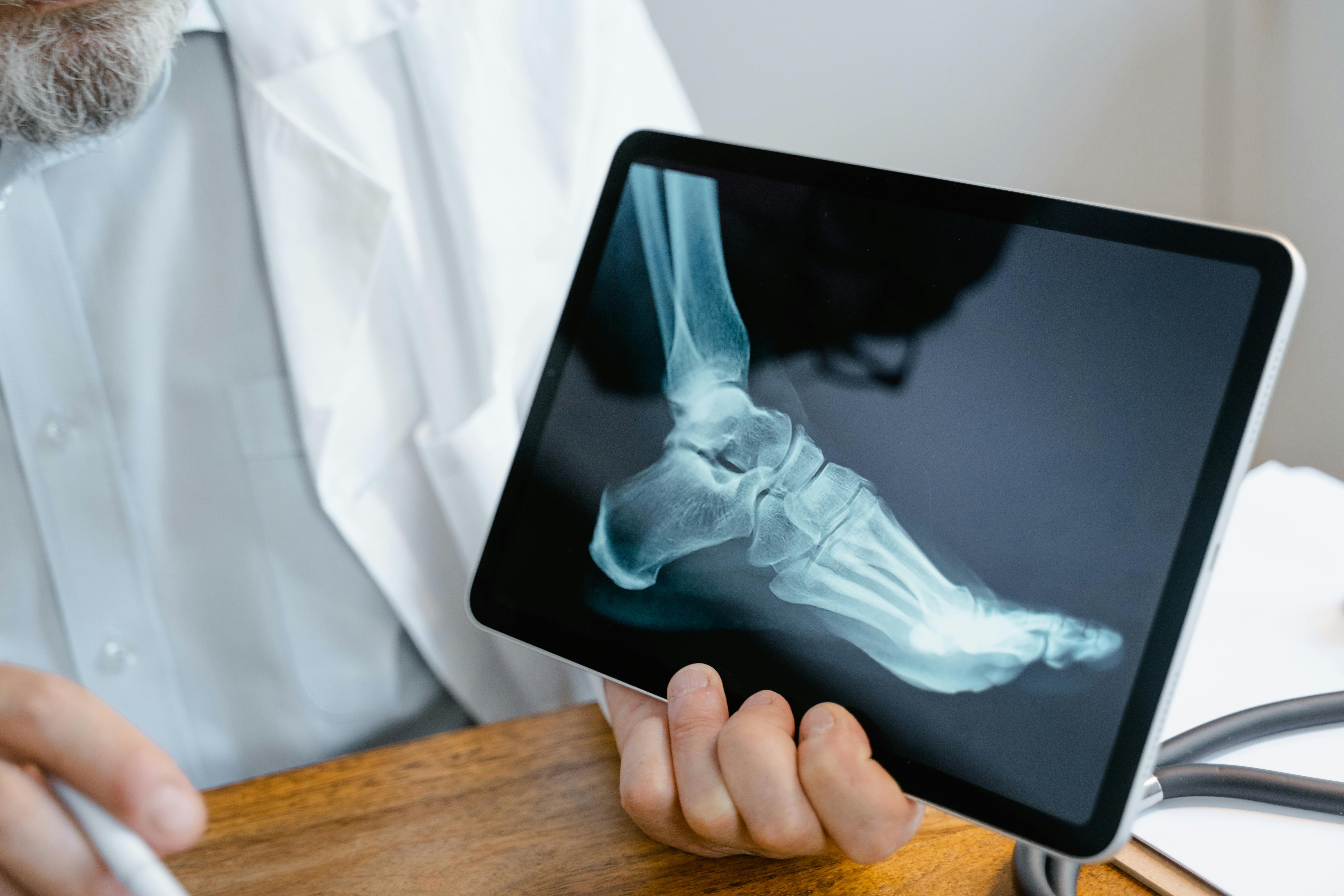 Maca powder for bone health - Shop ThemacaTeam.com.